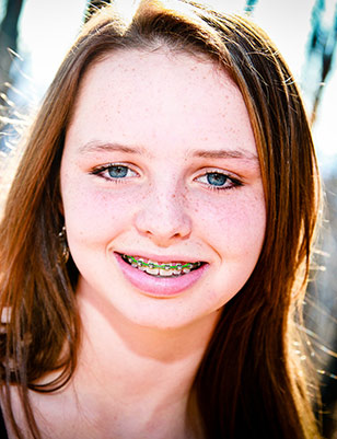 common orthodontic issues